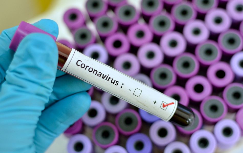 Γιατί δεν Είναι Ακόμη Αξιόπιστα τα Τεστ Αντισωμάτων για τον Κορωνοϊό;